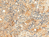 REG1B Polyclonal Antibody Reactivity Human