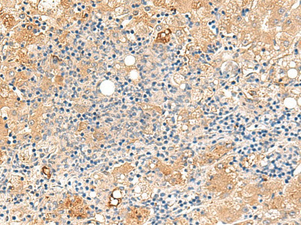 MEST Polyclonal Antibody Reactivity Human