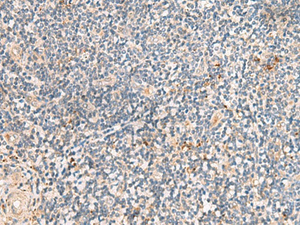 MEST Polyclonal Antibody Reactivity Human
