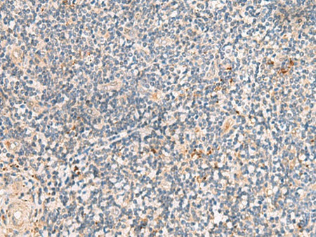 MEST Polyclonal Antibody Reactivity Human
