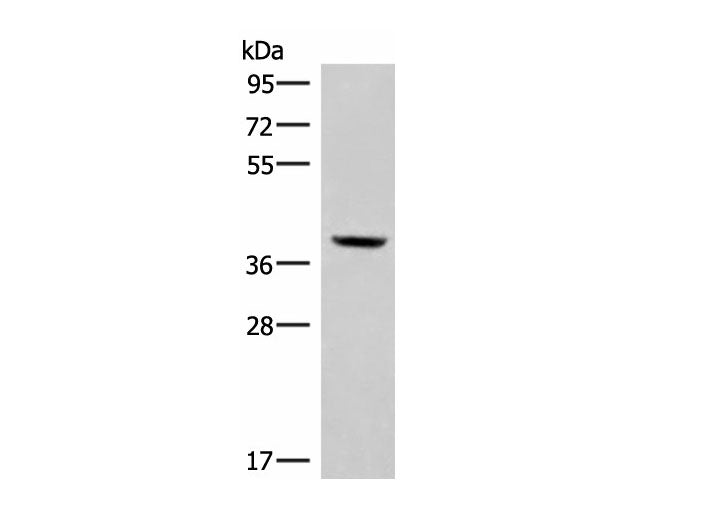 MEST Polyclonal Antibody Reactivity Human