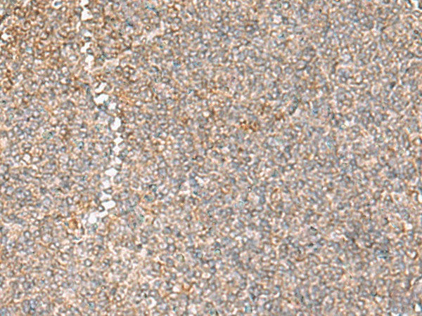 GIMAP2 Polyclonal Antibody Reactivity Human