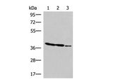 GIMAP2 Polyclonal Antibody Reactivity Human