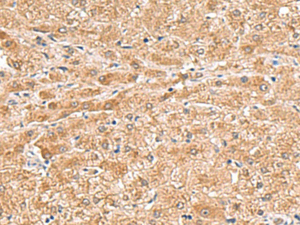 HMGCLL1 Polyclonal Antibody Reactivity Human