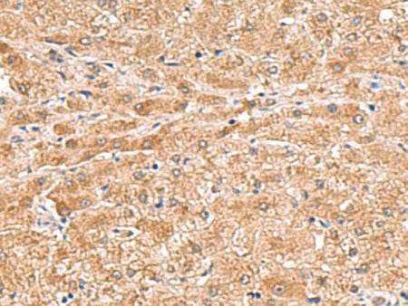 HMGCLL1 Polyclonal Antibody Reactivity Human