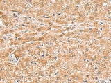 HMGCLL1 Polyclonal Antibody Reactivity Human