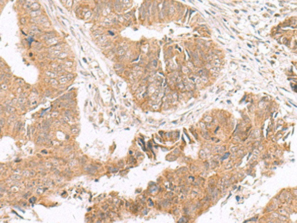 HMGCLL1 Polyclonal Antibody Reactivity Human