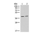 HMGCLL1 Polyclonal Antibody Reactivity Human