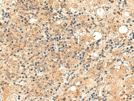 ZFYVE27 Polyclonal Antibody Reactivity Human