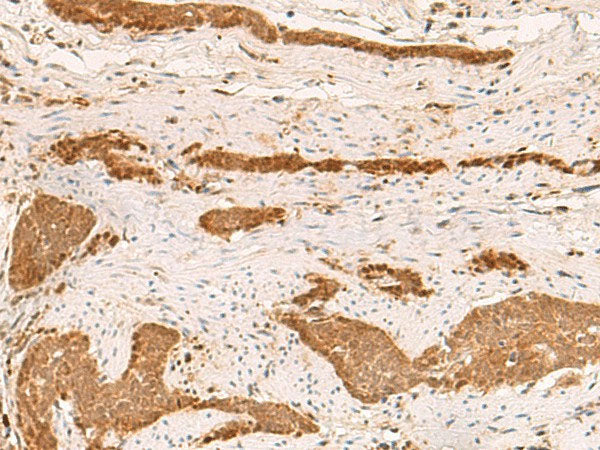 ZFYVE27 Polyclonal Antibody Reactivity Human