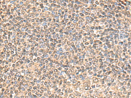 IQCD Polyclonal Antibody Reactivity Human