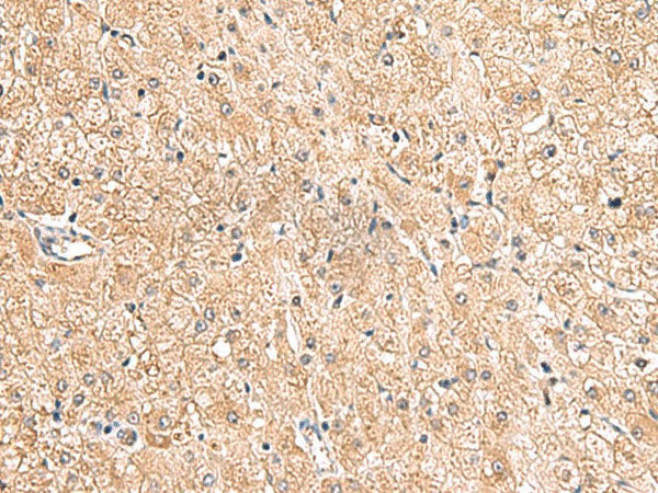 LRG1 Polyclonal Antibody Reactivity Human