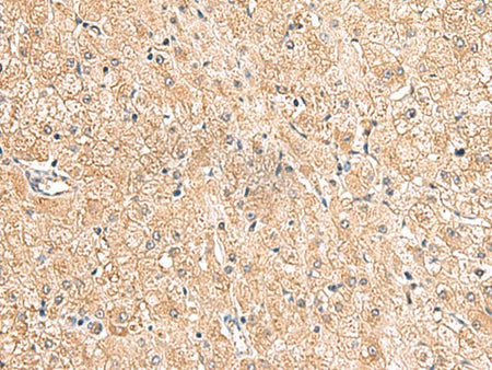 LRG1 Polyclonal Antibody Reactivity Human