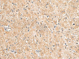 LRG1 Polyclonal Antibody Reactivity Human
