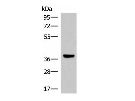 LRG1 Polyclonal Antibody Reactivity Human