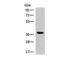 LRG1 Polyclonal Antibody Reactivity Human