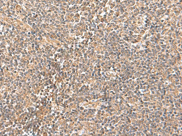 TRUB1 Polyclonal Antibody Reactivity Human