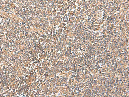 TRUB1 Polyclonal Antibody Reactivity Human