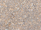 TRUB1 Polyclonal Antibody Reactivity Human