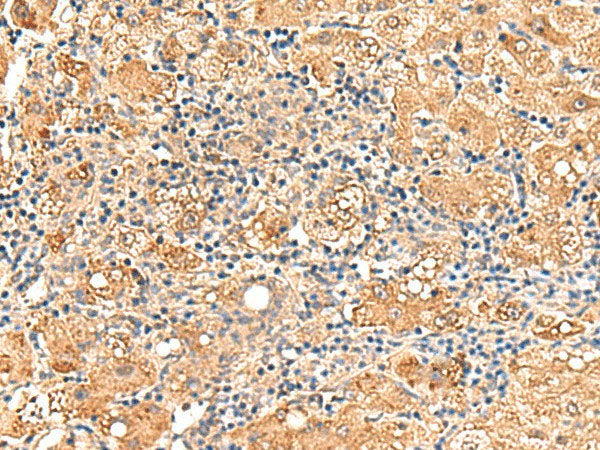 GPD1L Polyclonal Antibody Reactivity Human