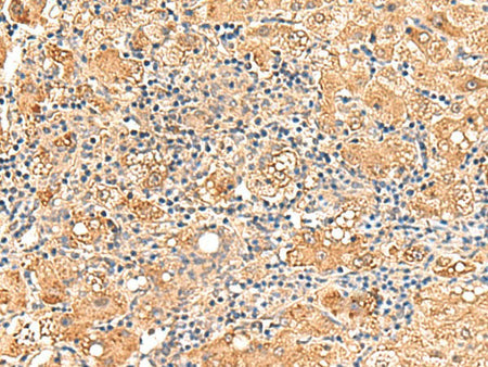 GPD1L Polyclonal Antibody Reactivity Human