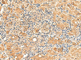 GPD1L Polyclonal Antibody Reactivity Human