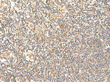 GPD1L Polyclonal Antibody Reactivity Human