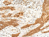 MKX Polyclonal Antibody Reactivity Human