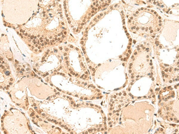 MKX Polyclonal Antibody Reactivity Human