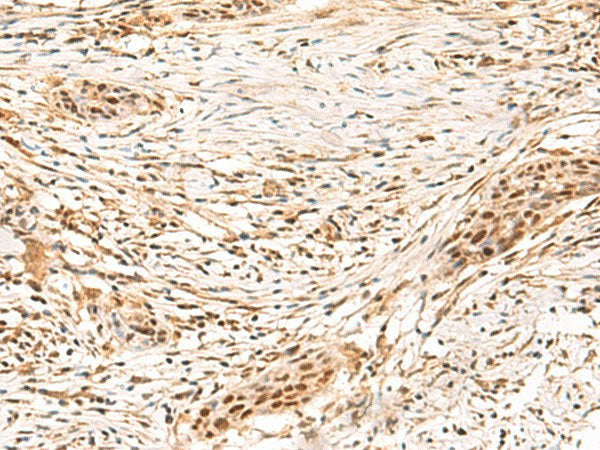 SETMAR Polyclonal Antibody Reactivity Human