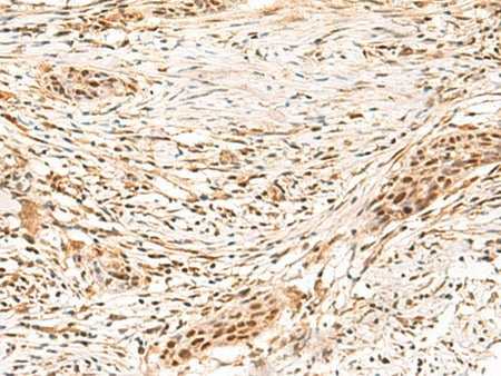 SETMAR Polyclonal Antibody Reactivity Human