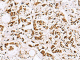 EWSR1 Polyclonal Antibody Reactivity Human