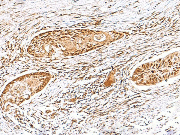 EWSR1 Polyclonal Antibody Reactivity Human