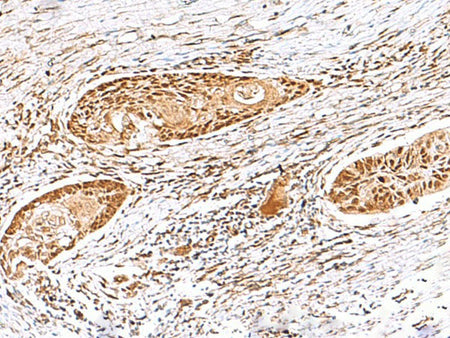 EWSR1 Polyclonal Antibody Reactivity Human