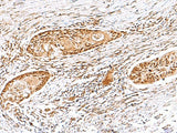 EWSR1 Polyclonal Antibody Reactivity Human