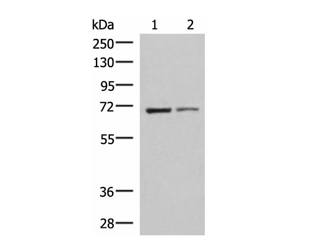 EWSR1 Polyclonal Antibody Reactivity Human