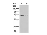 EWSR1 Polyclonal Antibody Reactivity Human