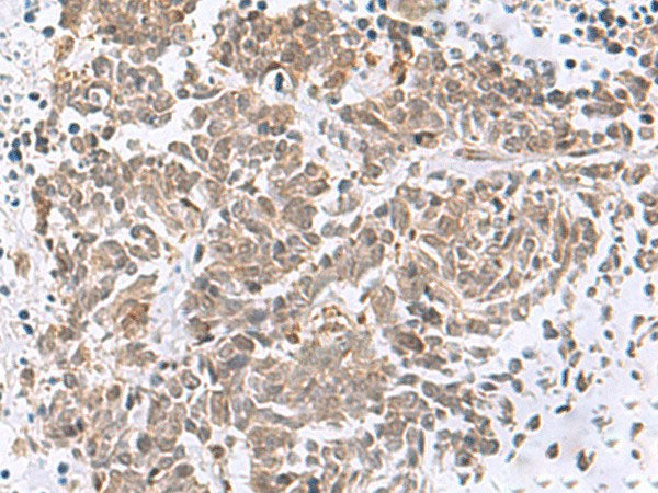 RBFOX2 Polyclonal Antibody Reactivity Human