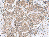 RBFOX2 Polyclonal Antibody Reactivity Human