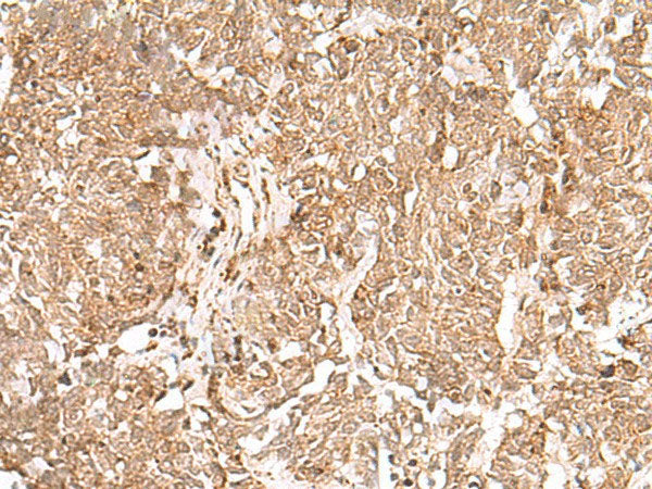 GMPPB Polyclonal Antibody Reactivity Human