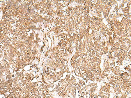 GMPPB Polyclonal Antibody Reactivity Human