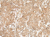 GMPPB Polyclonal Antibody Reactivity Human