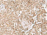 ELAC1 Polyclonal Antibody Reactivity Human