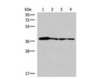 ELAC1 Polyclonal Antibody Reactivity Human