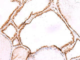 LMCD1 Polyclonal Antibody Reactivity Human