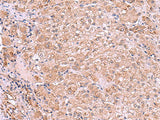 RIC3 Polyclonal Antibody
