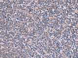 RIC3 Polyclonal Antibody