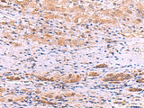 DHPS Polyclonal Antibody Reactivity Human
