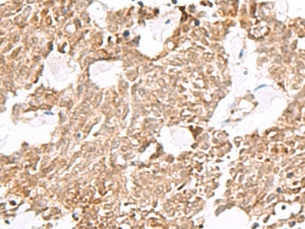 ELF3 Polyclonal Antibody Reactivity Human