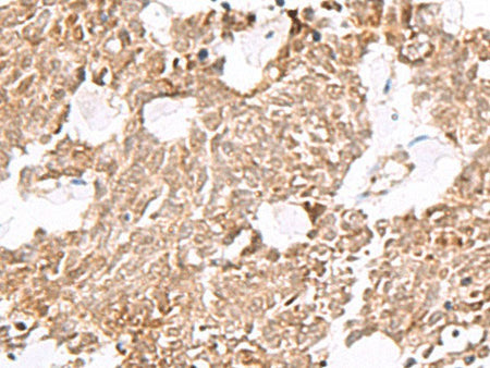 ELF3 Polyclonal Antibody Reactivity Human